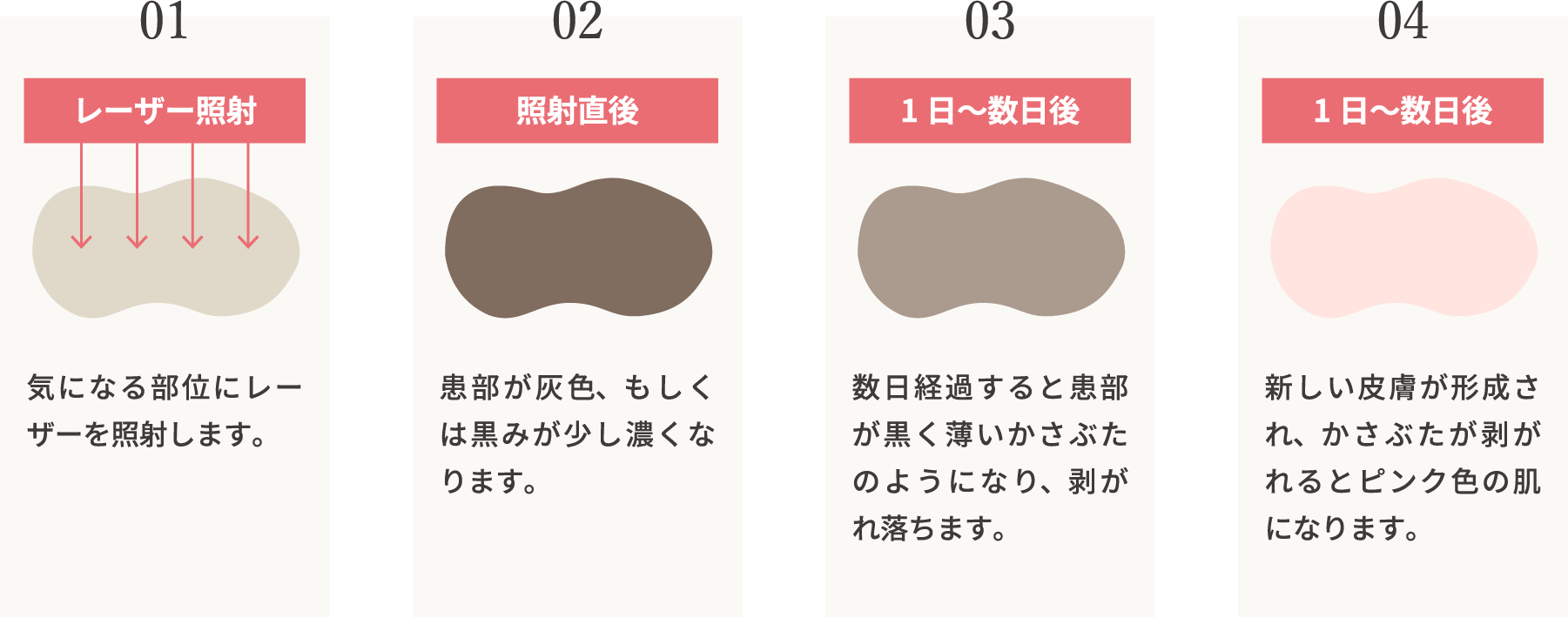 ピコスポット(シミ取り)