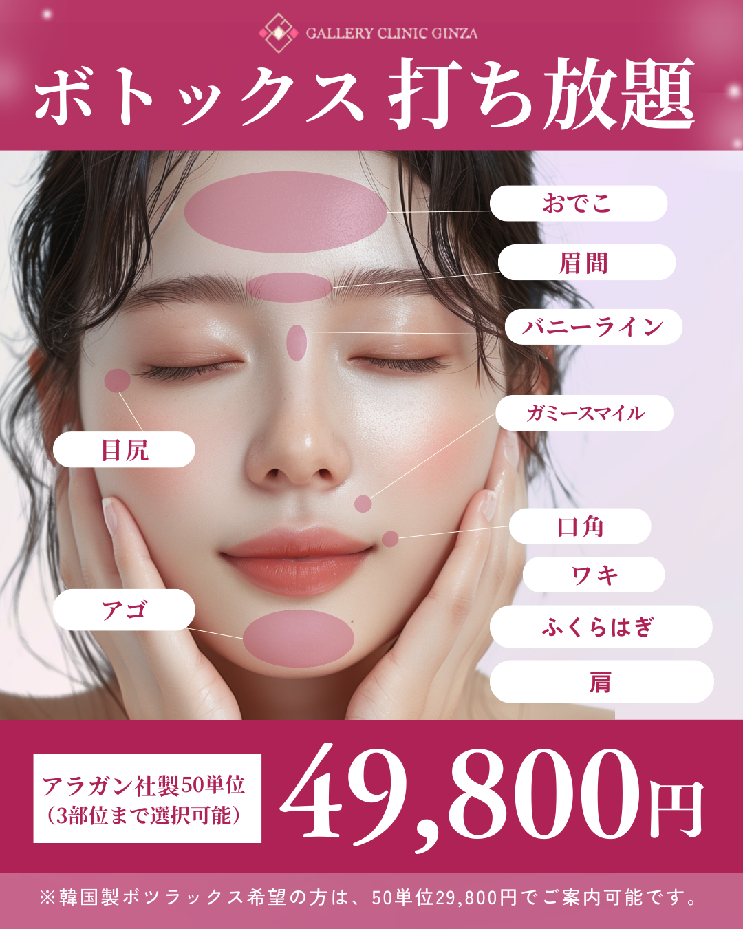 ボトックス